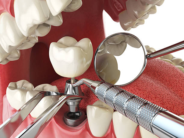 Best Weekend Emergency Dental Services in Jamestown, OH
